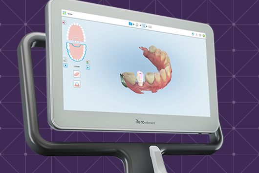 Align Technology Announces New iTero Lumina™ Intraoral Scanner Featuring a  3X Wider Field of Capture1 in a 50% Smaller Wand2 That Delivers Faster  Scanning, Higher Accuracy3, and Superior Visualization4 for Greater Practice